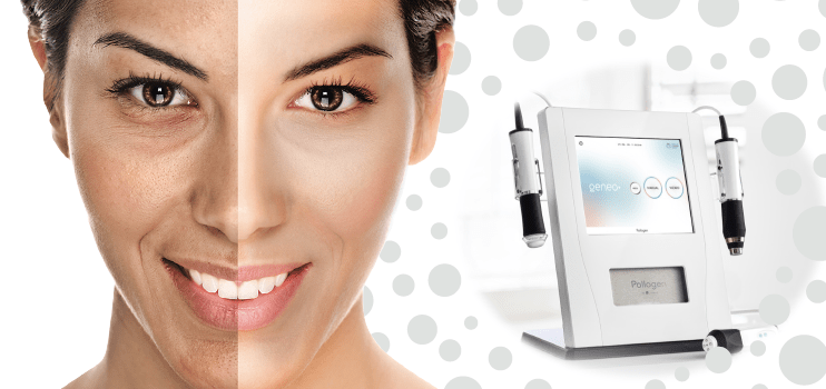 Nouveauté : l'appareil OxyGeneo pour des soins du visage hors du commun !
