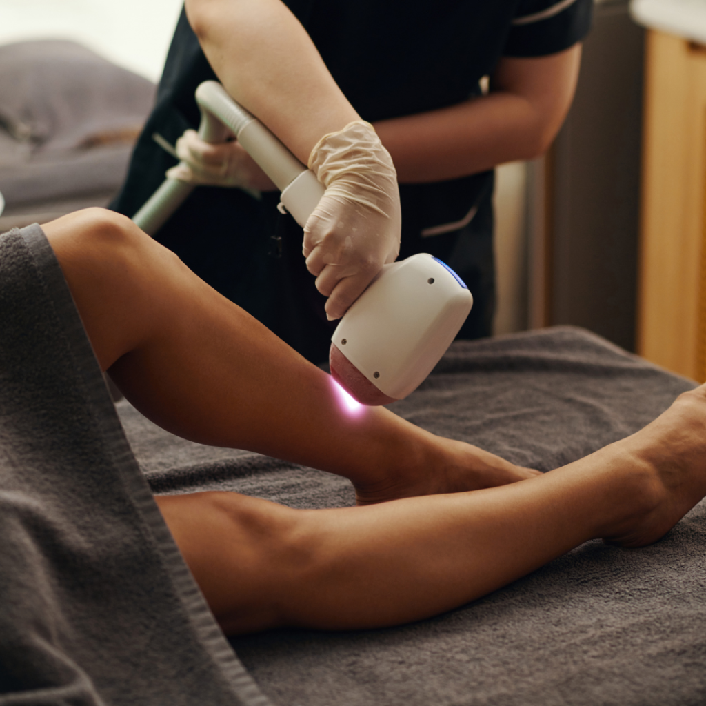 epilation laser montréal