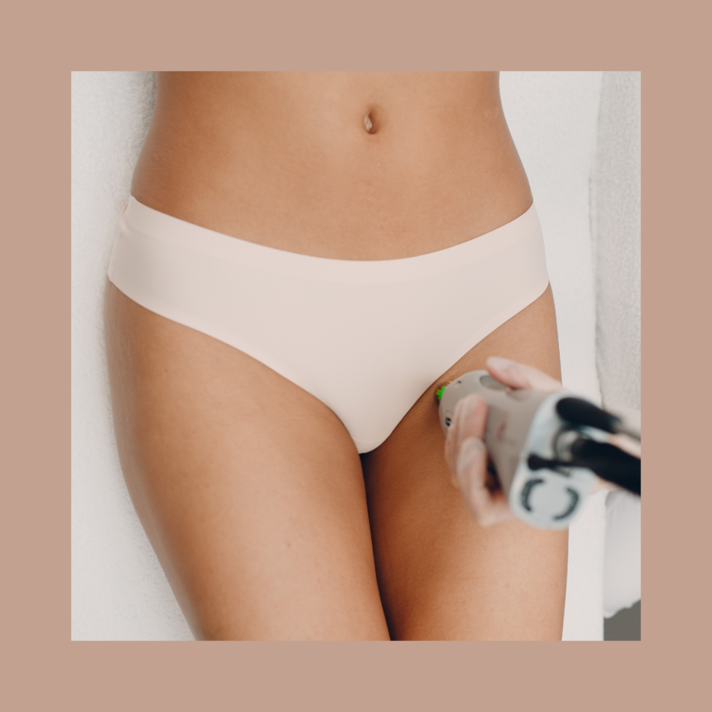 épilation laser montréal