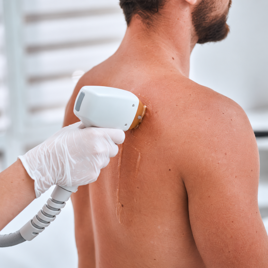 laser hair removal montreal soprano titanium back