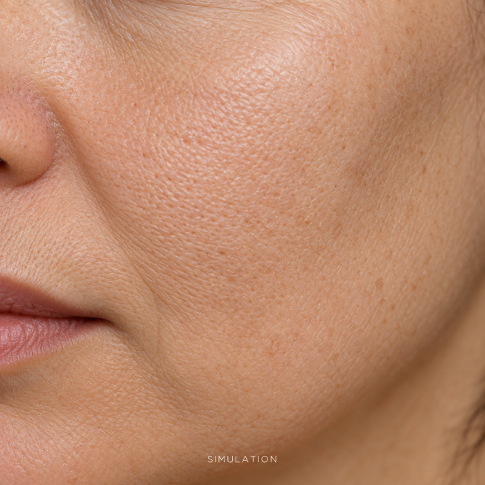 Collagen Facial before